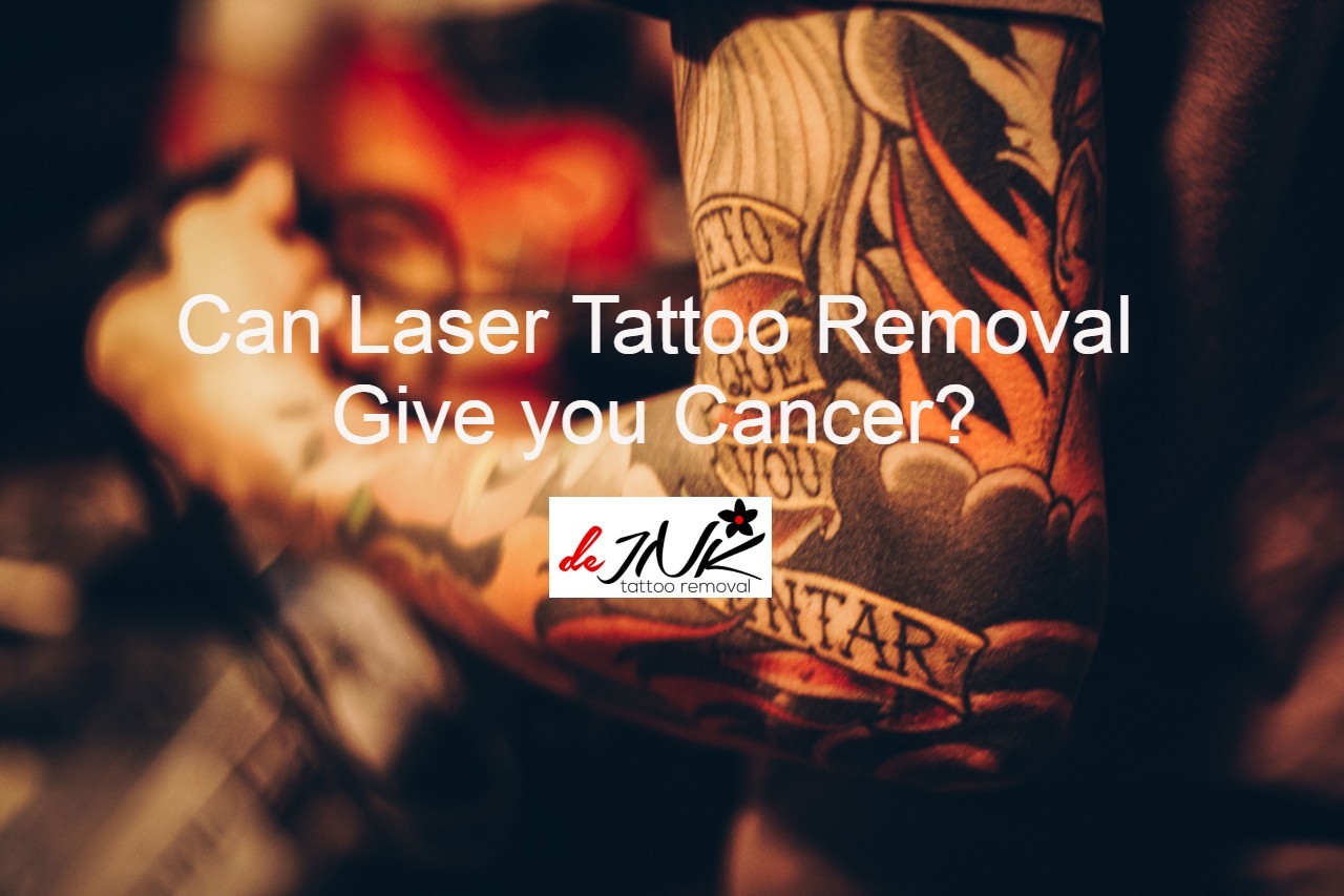 Laser Tattoo Removal Cancer Risk: All the Facts You’ll Ever Need to Know